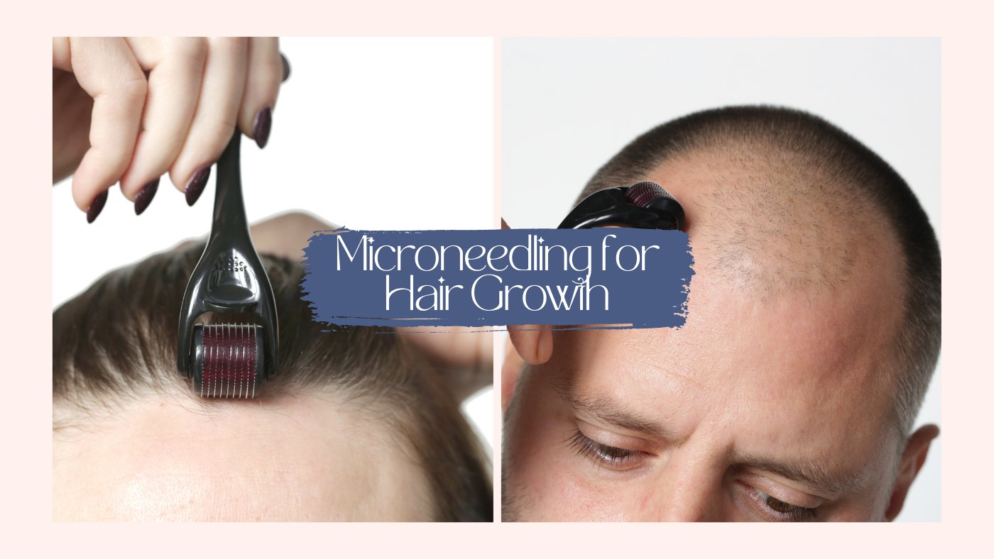 How Microneedling Helps Hair Regrowth - SkinBay