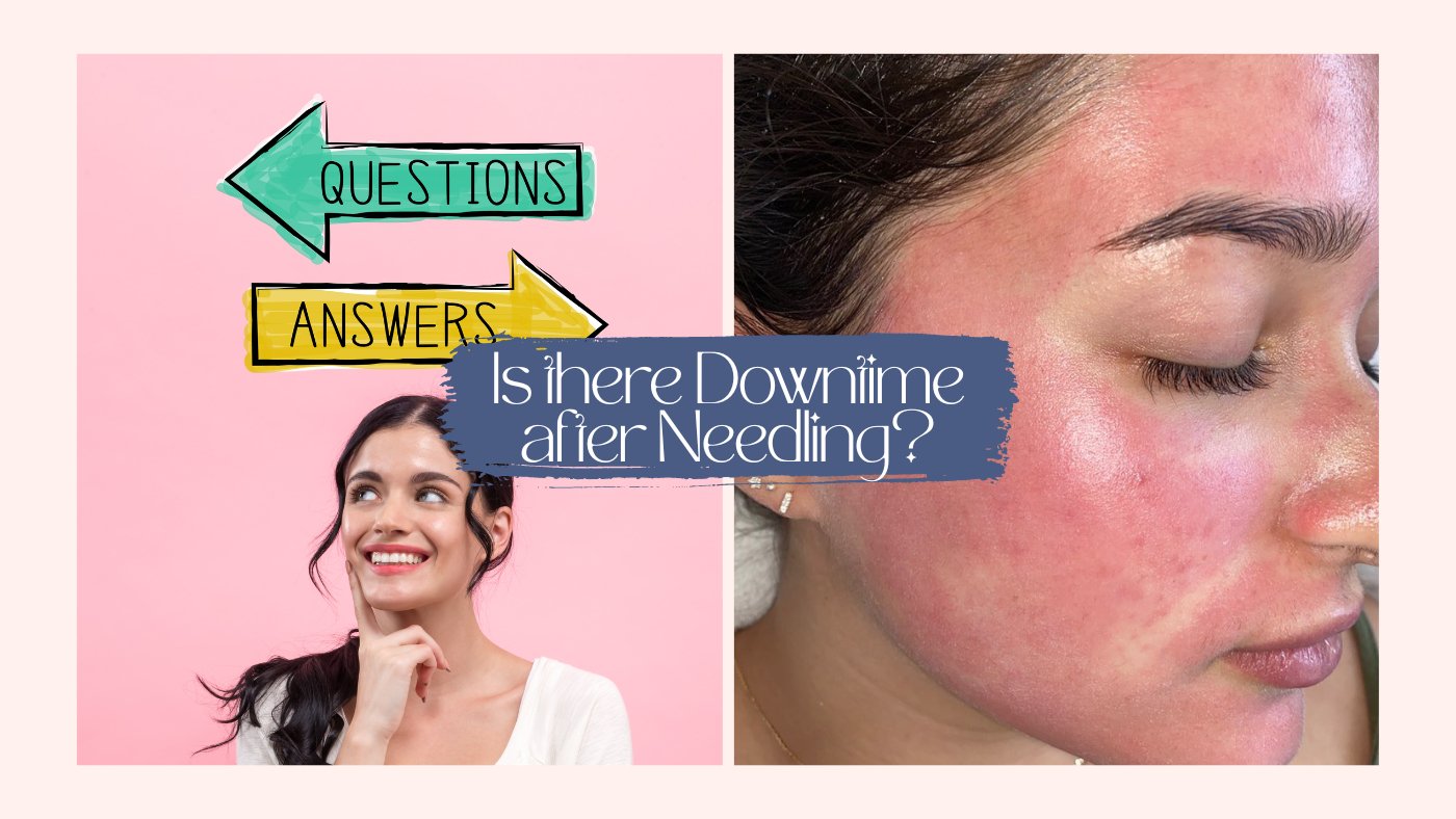 Is there downtime after Microneedling? - SkinBay