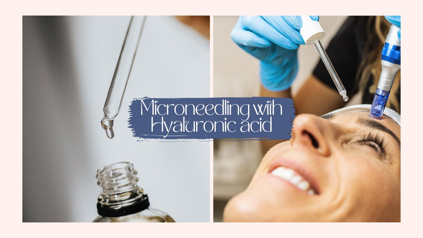 Maximizing Results: Microneedling with Hyaluronic Acid - SkinBay