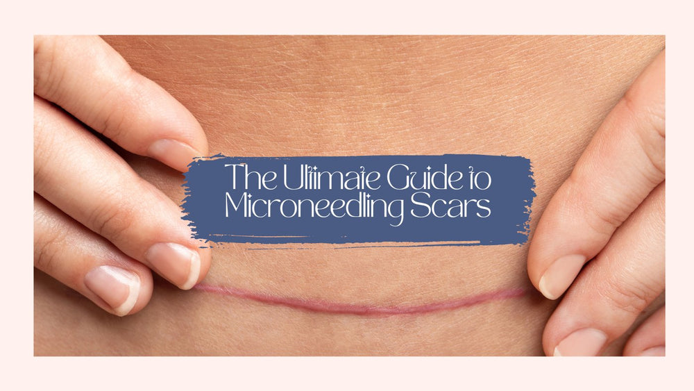 The Ultimate Guide to Microneedling Scars - SkinBay