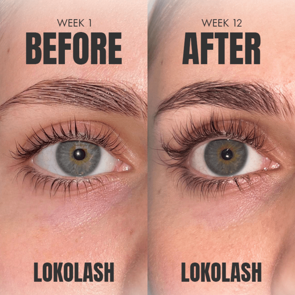 
                  
                    LOKOLASH SERUM PRO 3ml - SkinBay
                  
                