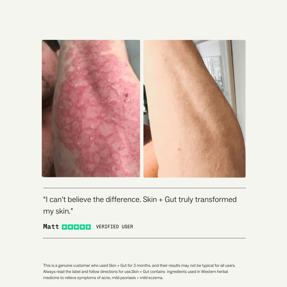 
                  
                    Skin + Gut™60 Capsules | My Way Up® - SkinBay
                  
                